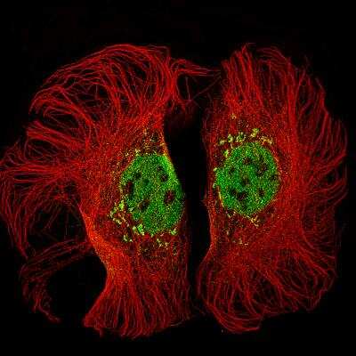 Immunocytochemistry/Immunofluorescence: KMT2D Antibody (CL5346) [NBP2-61416] - Staining of CACO-2 cells using the Anti-KMT2D monoclonal antibody, showing specific staining in the nucleoplasm and golgi apparatus in green. Microtubule- and nuclear probes are visualized in red and blue, respectively (where available). Antibody staining is shown in green.