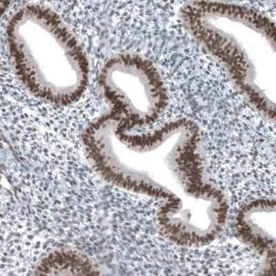 Immunohistochemistry-Paraffin: KMT2D Antibody [NBP1-89123] - Staining of human endometrium shows moderate nuclear positivity in glandular cells.