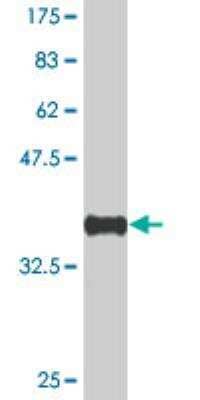 Western Blot: KMT3B/NSD1 Antibody (1C12) [H00064324-M05] - Detection against Immunogen (37.62 KDa) . 