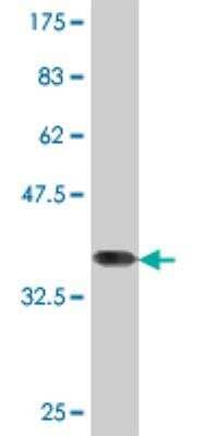 Western Blot: KMT3B/NSD1 Antibody (3E6) [H00064324-M06] - Western Blot detection against Immunogen (37.62 KDa)