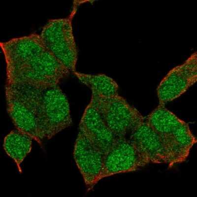 Immunocytochemistry/Immunofluorescence: KMT3B/NSD1 Antibody [NBP2-55512] - Staining of human cell line HEK 293 shows localization to nucleus & cytosol.