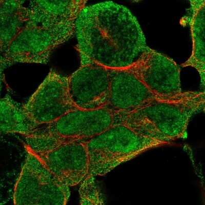 Immunocytochemistry/Immunofluorescence: KMT3B/NSD1 Antibody [NBP2-56325] - Staining of human cell line HEK 293 shows localization to nucleus & plasma membrane.