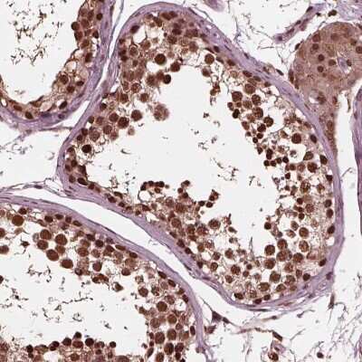 Immunohistochemistry: KMT3B/NSD1 Antibody [NBP2-68968] - Immunohistochemical staining of human testis shows strong nuclear positivity in cells in seminiferous ducts and Leydig cells.