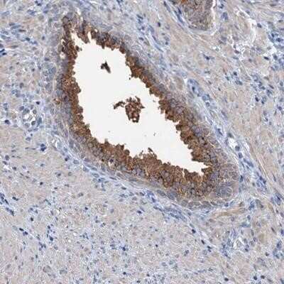 Immunohistochemistry-Paraffin: KNDC1 Antibody [NBP1-90772] - Staining of human prostate shows strong cytoplasmic positivity in glandular cells.