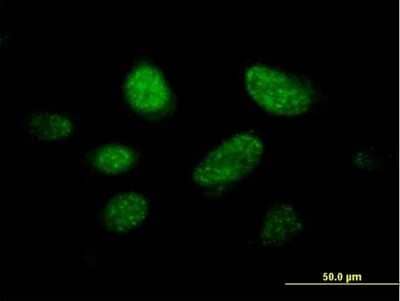 Immunocytochemistry/ Immunofluorescence KNL-2 Antibody - Azide and BSA Free