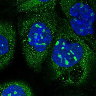 Immunocytochemistry/Immunofluorescence: KNOP1 Antibody [NBP2-48730] - Staining of human cell line A-431 shows localization to nucleoli & cytosol. Antibody staining is shown in green.
