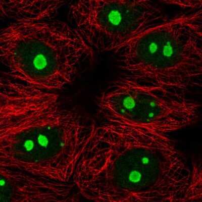 Immunocytochemistry/Immunofluorescence: KNOP1 Antibody [NBP2-55695] - Staining of human cell line MCF7 shows localization to nucleoli.