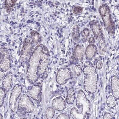 Immunohistochemistry-Paraffin: KNOP1 Antibody [NBP2-48730] - Staining of human stomach, upper shows distinct nucleolar positivity in glandular cells.
