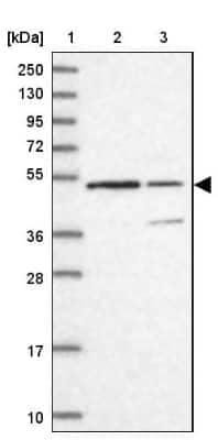 Western Blot: KNOP1 Antibody [NBP2-48730] - Lane 1: Marker [kDa] 250, 130, 95, 72, 55, 36, 28, 17, 10Lane 2: Human cell line RT-4Lane 3: Human cell line U-251MG sp