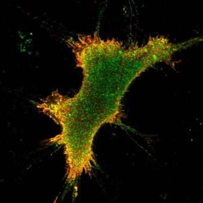 Immunocytochemistry/Immunofluorescence: KOR Antibody [NBP2-68859] - Staining of human cell line AF22 shows localization to plasma membrane & cytosol.