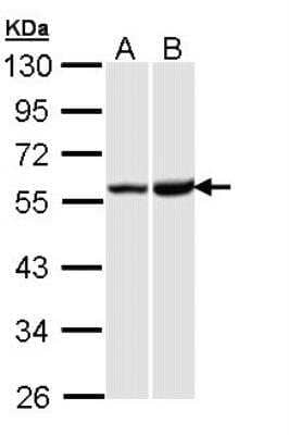 Western Blot: KOR Antibody [NBP2-17015] -  Sample (30 ug of whole cell lysate) A: Hep G2 B: Raji 10% SDS PAGE gel, diluted at 1:1000.