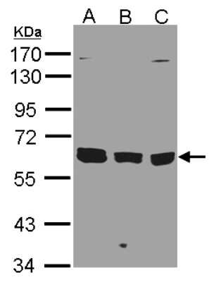 Western Blot: KPNA3 Antibody [NBP1-31031] - Sample(30 ug of whole cell lysate)A:293TB:A431 C:H129910% SDS PAGE, antibody diluted at 1:1500.