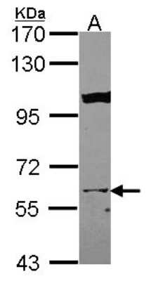 Western Blot: KPNA3 Antibody [NBP2-17088] - Sample (30 ug of whole cell lysate) A: HCT116 7. 5% SDS PAGE gel, diluted at 1:2000.