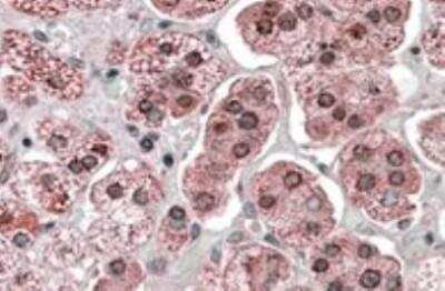 Immunohistochemistry-Paraffin KPNA6 Antibody