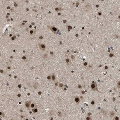 Immunohistochemistry-Paraffin: KPNA6 Antibody [NBP1-83762] - Staining of human cerebral cortex shows moderate to strong nuclear and cytoplasmic positivity in neurons.