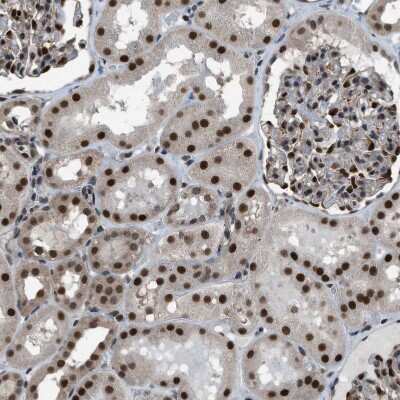 Immunohistochemistry-Paraffin: KPNA6 Antibody [NBP1-83762] - Staining of human kidney shows moderate to strong nuclear positivity in cells in tubules.