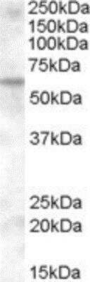 Western Blot KPNA6 Antibody