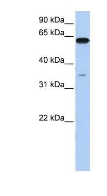 Western Blot: KPNA6 Antibody [NBP1-52953] - Titration: 0.2-1 ug/ml, Positive Control: Human brain.