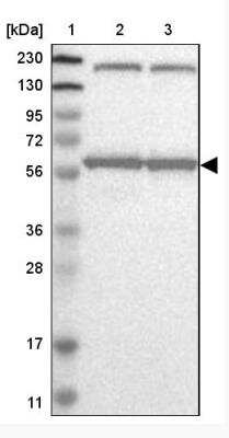 Western Blot: KPNA6 Antibody [NBP1-83762] - Lane 1: Marker [kDa] 230, 130, 95, 72, 56, 36, 28, 17, 11 Lane 2: Human cell line RT-4 Lane 3: Human cell line U-251MG sp