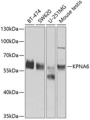 Western Blot: KPNA6 Antibody [NBP3-04919] - Analysis of extracts of various cell lines, using KPNA6 antibody at 1:1000 dilution. Secondary antibody: HRP Goat Anti-Rabbit IgG (H+L) at 1:10000 dilution. Lysates/proteins: 25ug per lane. Blocking buffer: 3% nonfat dry milk in TBST. Detection: ECL Basic Kit