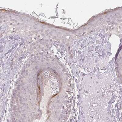 Immunohistochemistry: KPRP Antibody [NBP2-38194] - Staining of human skin shows moderate positivity in a subset of keratinocytes.