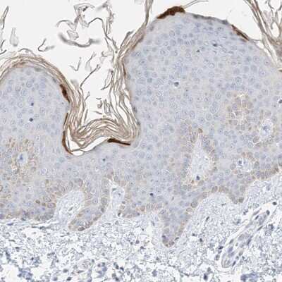 Immunohistochemistry-Paraffin: KPRP Antibody [NBP1-90707] - Staining of human skin shows high expression.