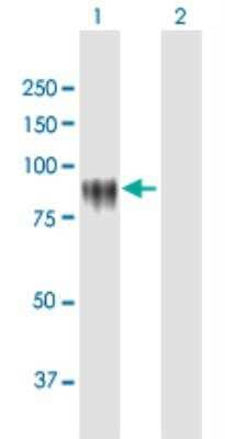 Western Blot: KPRP Antibody [H00448834-B01P-50ug] - analysis of KPRP expression in transfected 293T cell line (H00448834-T01) by KPRP MaxPab polyclonal antibody.Lane 1: KPRP transfected lysate(63.69 KDa).Lane 2: Non-transfected lysate.