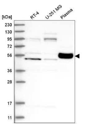 Western Blot: KPRP Antibody [NBP2-38194] - Analysis in human cell line RT-4, human cell line U-251 MG and human plasma.
