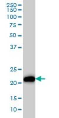 Western Blot: KRAS Antibody (4F3) [H00003845-M02] - KRAS monoclonal antibody (M02), clone 4F3 Analysis of KRAS expression in HeLa.