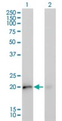 Western Blot: KRAS Antibody (4F3) [H00003845-M02] - Analysis of KRAS expression in transfected 293T cell line by KRAS monoclonal antibody (M02), clone 4F3.Lane 1: KRAS transfected lysate(21 KDa).Lane 2: Non-transfected lysate.
