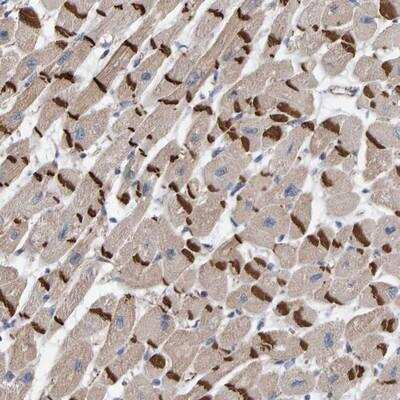 Immunohistochemistry-Paraffin: KRBA2 Antibody [NBP1-86005] - Staining of human heart muscle shows strong positivity in the intercalated discs.