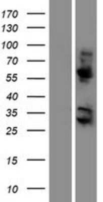 Western Blot: KRBA2 Overexpression Lysate (Adult Normal) [NBP2-04476] Left-Empty vector transfected control cell lysate (HEK293 cell lysate); Right -Over-expression Lysate for KRBA2.