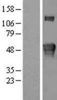 Western Blot: KREMEN2 Overexpression Lysate (Adult Normal) [NBL1-12378] Left-Empty vector transfected control cell lysate (HEK293 cell lysate); Right -Over-expression Lysate for KREMEN2.