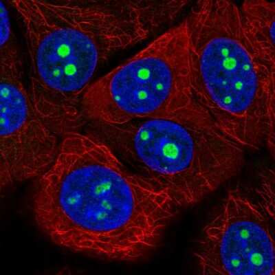 Immunocytochemistry/Immunofluorescence: KRI1 Antibody [NBP2-14174] - Immunofluorescent staining of human cell line MCF7 shows localization to nucleoli.