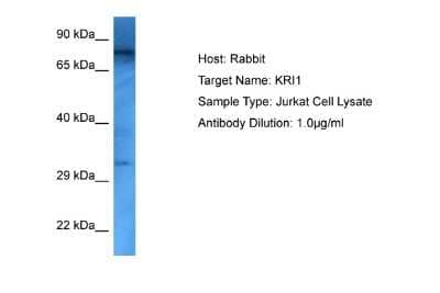 Western Blot: KRI1 Antibody [NBP2-85165] - Host: Rabbit. Target Name: KRI1. Sample Tissue: Human Jurkat Whole Cell lysates. Antibody Dilution: 1ug/ml