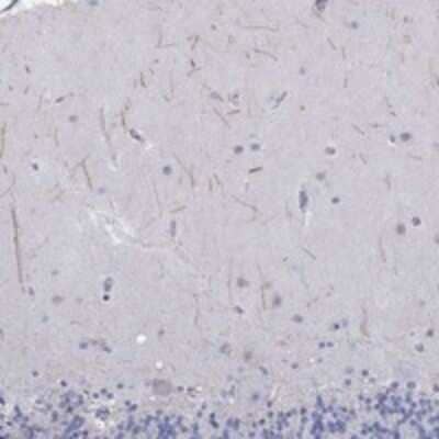 Immunohistochemistry-Paraffin: KRT222 Antibody [NBP3-17269] - Staining of human cerebellum shows positivity in neuropil.