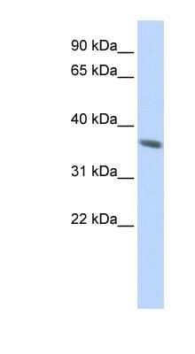 Western Blot: KRT222 Antibody [NBP1-70595] - Jurkat cell lysate, concentration 0.2-1 ug/ml.