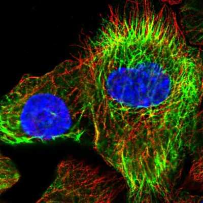Immunocytochemistry/Immunofluorescence: KRT24 Antibody [NBP1-83665] - Immunofluorescent staining of human cell line A-431 shows localization to intermediate filaments.