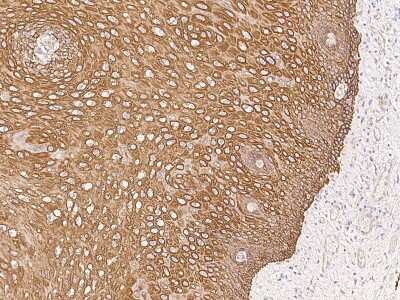 Immunohistochemistry-Paraffin: KRT24 Antibody [NBP2-99291] - Immunochemical staining of human KRT24 in human esophagus with rabbit polyclonal antibody at 1:2000 dilution, formalin-fixed paraffin embedded sections.