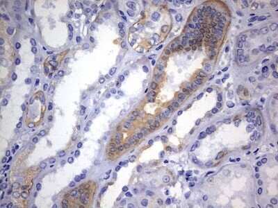 Immunohistochemistry: KRT24 Antibody (OTI4E8) - Azide and BSA Free [NBP2-72455] - Analysis of Human Kidney tissue. (Heat-induced epitope retrieval by 1 mM EDTA in 10mM Tris, pH9.0, 120C for 3min)