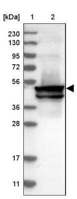 Western Blot KRT24 Antibody - BSA Free