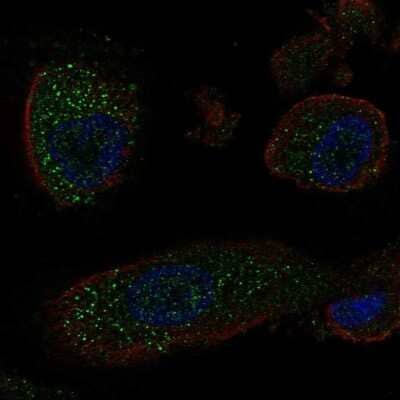 Immunocytochemistry/ Immunofluorescence KRT25 Antibody - BSA Free