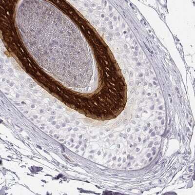Immunohistochemistry-Paraffin: KRT25 Antibody [NBP2-30606] - Staining of human hair follicles shows strong cytoplasmic positivity in cells in internal root sheath.