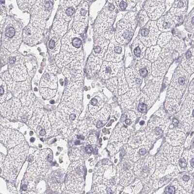 Immunohistochemistry-Paraffin: KRT25 Antibody [NBP2-30606] - Staining of human liver.