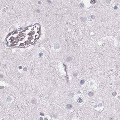 Immunohistochemistry-Paraffin: KRT25 Antibody [NBP2-30606] - Staining of human cerebral cortex.