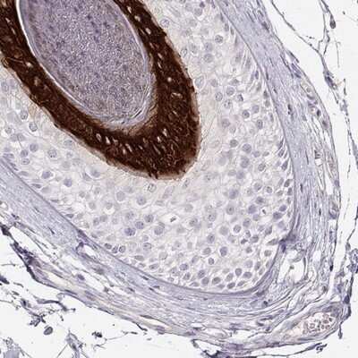 Immunohistochemistry-Paraffin KRT25 Antibody - BSA Free