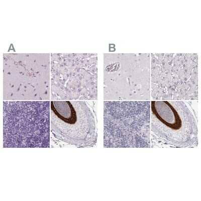Immunohistochemistry-Paraffin KRT25 Antibody - BSA Free