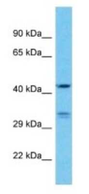 Western Blot KRT33A Antibody - BSA Free