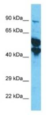 Western Blot KRT33A Antibody - BSA Free
