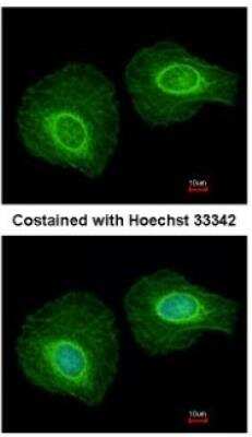 Immunocytochemistry/Immunofluorescence: KRT34 Antibody [NBP1-33423] - Analysis of methanol-fixed HeLa, using antibody at 1:200 dilution.